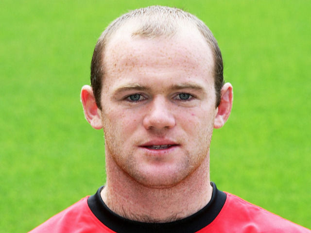 Wayne-Rooney-greffe-de-cheveux.jpg