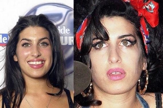 Amy Winehouse avant apres Les Stars avant / après la vieillesse