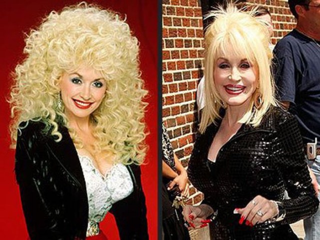 Dolly Parton avant apres Les Stars avant / après la vieillesse