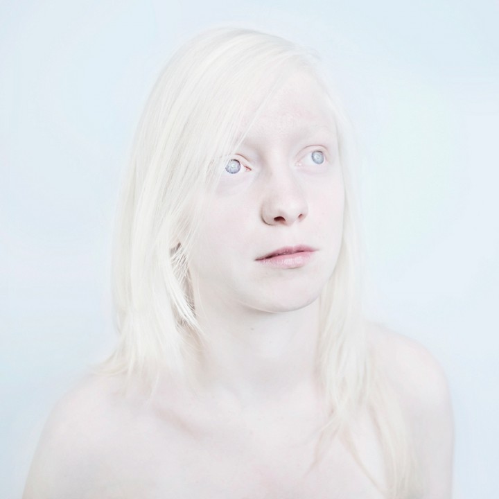 Albinos Sanne De Wilde