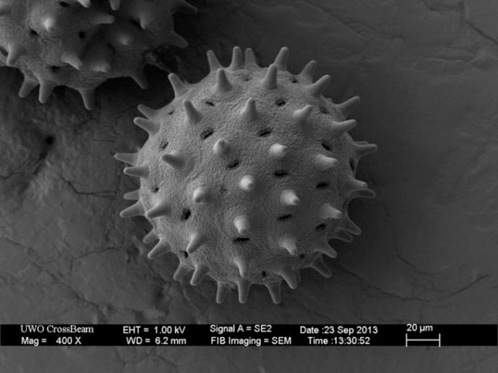 pollen vue microscope