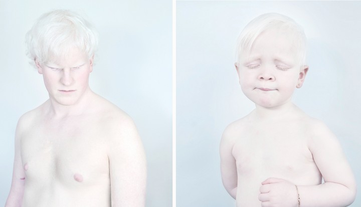 De Wilde albinos