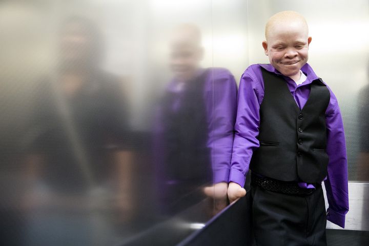 enfants albinos new york 10