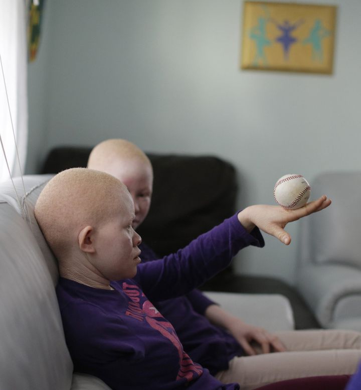 Kabula Masanja, foreground, plays with a baseball, accompanied by Pendo Noni in New York on Wednesday, July 1, 2015. The children were attacked and dismembered in the belief that their body parts will bring wealth. (AP Photo/Julie Jacobson)