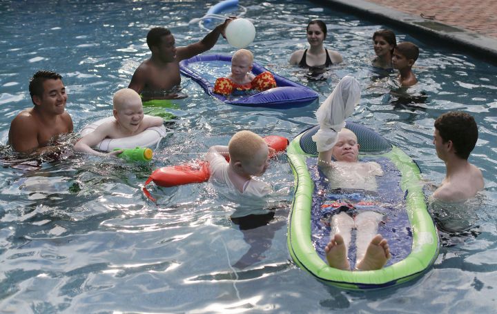 enfants albinos new york 13