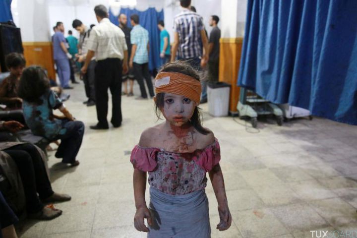 A wounded Syrian girl looks on at a make shift hospital in the rebel-held area of Douma, east of the capital Damascus, following shelling and air raids by Syrian government forces on August 22, 2015. At least 20 civilians and wounded or trapped 200 in Douma, a monitoring group said, just six days after regime air strikes killed more than 100 people and sparked international condemnation of one of the bloodiest government attacks in Syria's war. AFP PHOTO / ABD DOUMANY (Photo credit should read ABD DOUMANY/AFP/Getty Images)