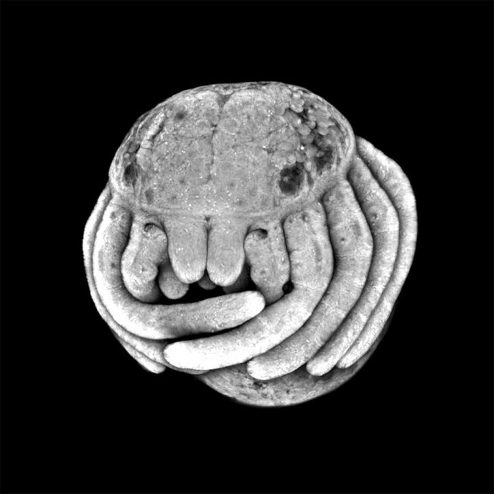 photo araignee microscopique embryon