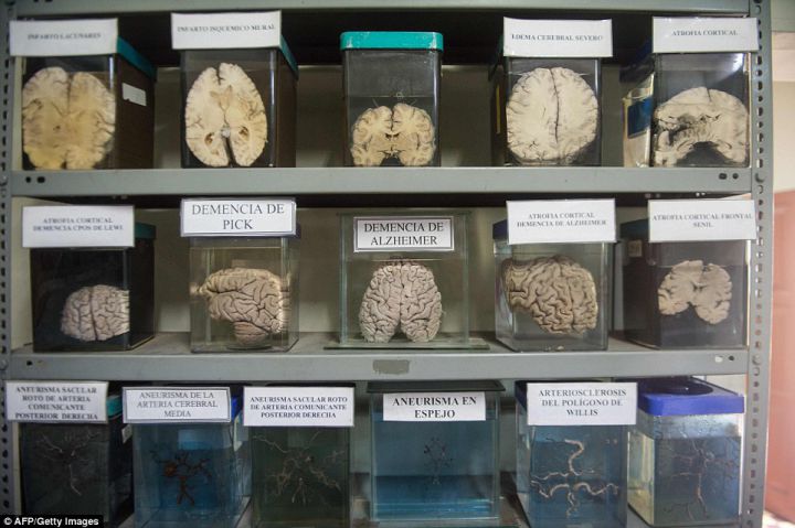 musée cerveaux