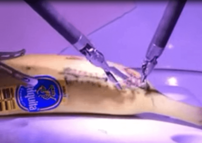 Un médecin basé à Londres a opéré une banane en Californie en utilisant la 5G