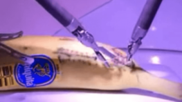 Un médecin basé à Londres a opéré une banane en Californie en utilisant la 5G