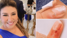 Cette mère de famille développe un cancer de l'ongle après une manucure ratée !