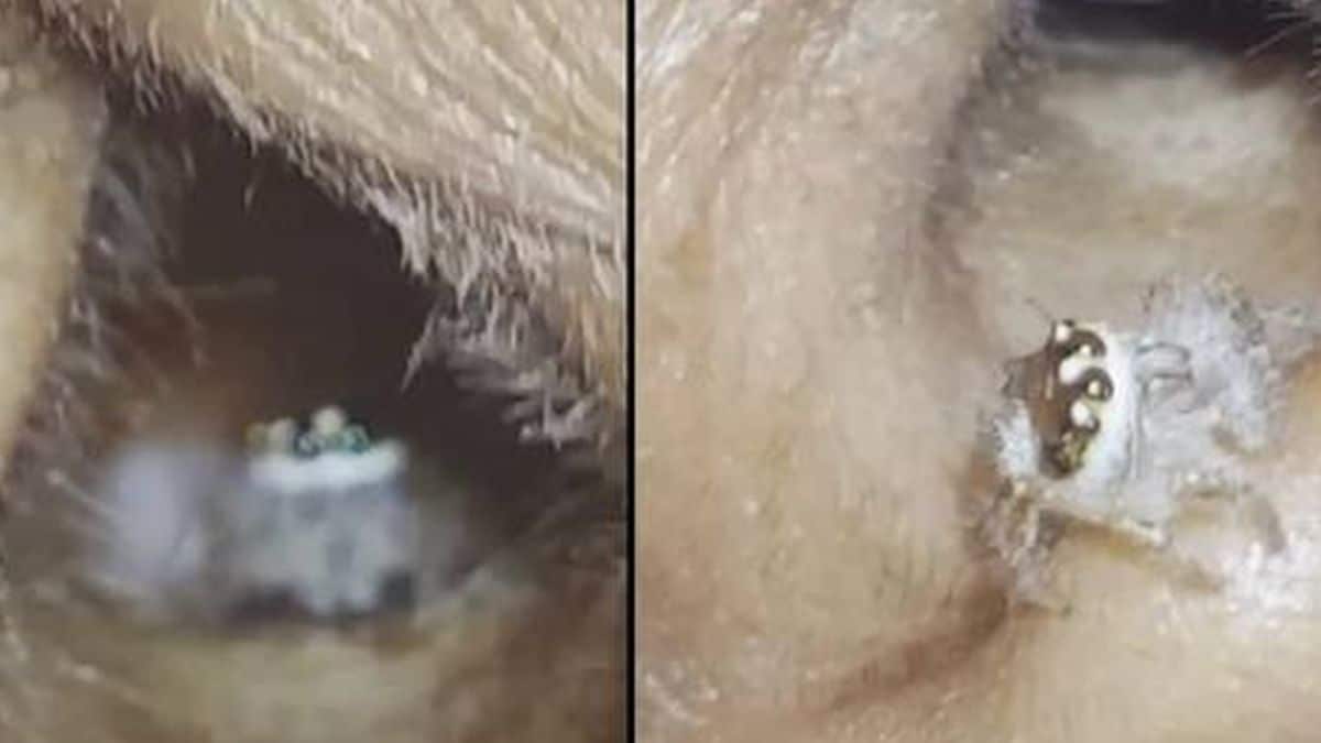 Les internautes horrifiés par cette vidéo montrant une araignée rampant dans l'oreille de cette personne
