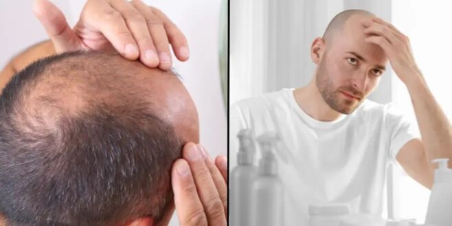 Les scientifiques découvrent un «remède contre la calvitie» grâce au «gène de l'homme des cavernes»