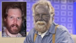 Cet homme devient tout bleu après avoir consommé ces aliments trop longtemps !