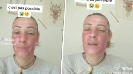 Elle teste un masque Action qui cartonne sur TikTok mais sa séance beauté tourne au drame !