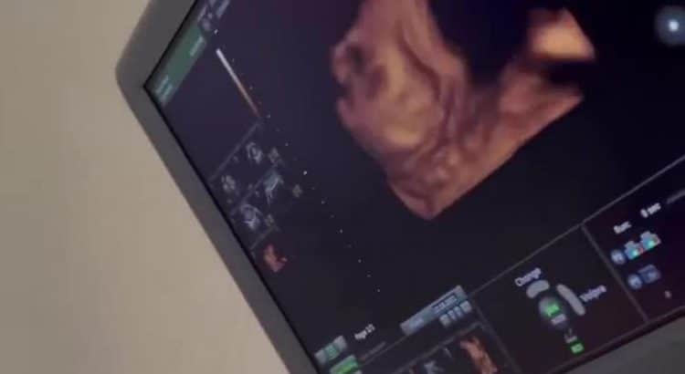 Jazz Correia dévoile le sexe de son bébé sur Instagram !