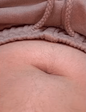 À 20 ans, elle assume ses poils et les affiche sans complexe sur la Toile ! (photos)