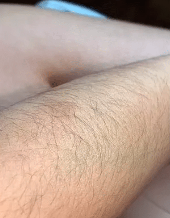 À 20 ans, elle assume ses poils et les affiche sans complexe sur la Toile ! (photos)