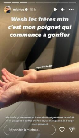 Michou très inquiet pour sa santé, il prend la parole ! 