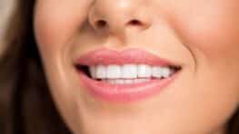 9 astuces magiques et pas chères pour avoir les dents blanches sans aller chez le dentiste !