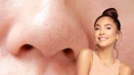 Cette lotion anti points noirs ultra efficace cartonne partout !