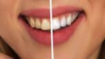 Le dentifrice naturel pour éclaircir les dents de 4 teintes en 21 jours selon cette étude !