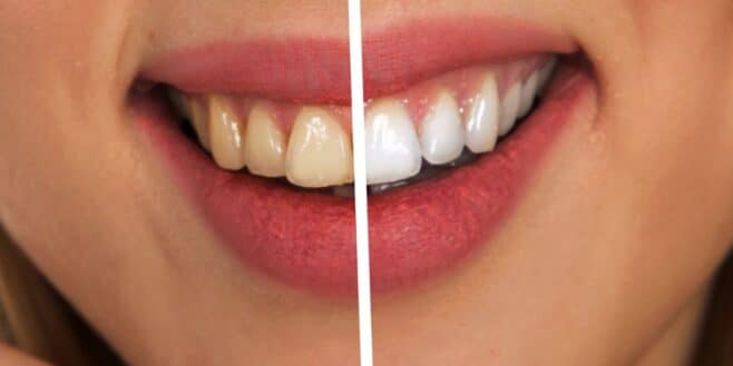 Le dentifrice naturel pour éclaircir les dents de 4 teintes en 21 jours selon cette étude !
