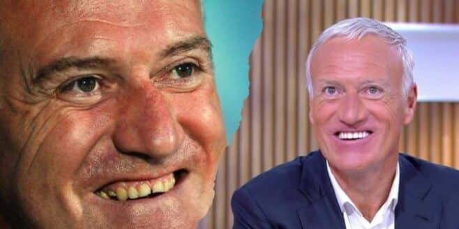 Didier Deschamps cette somme hallucinante qu'il a dépensé pour refaire ses dents !