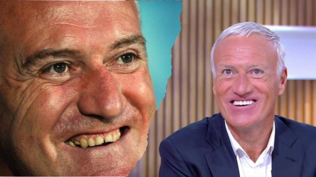 Didier Dechamp Urprend Tout Le Monde Avec... E Nouvelle Dent ! (PHOTO