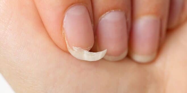 Vos ongles donnent des informations essentielles sur votre état de santé
