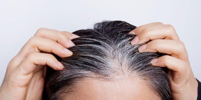 Ralentir efficacement l'apparition des cheveux blancs grâce à ces 2 vitamines