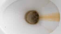 La solution miracle pour enlever tout le calcaire des WC sans efforts