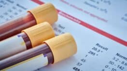 Les personnes avec ce groupe sanguin vieillissent moins vite que les autres