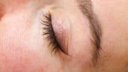 Ce simple détail sur vos paupières pourrait révéler un risque cardiaque caché, selon un médecin