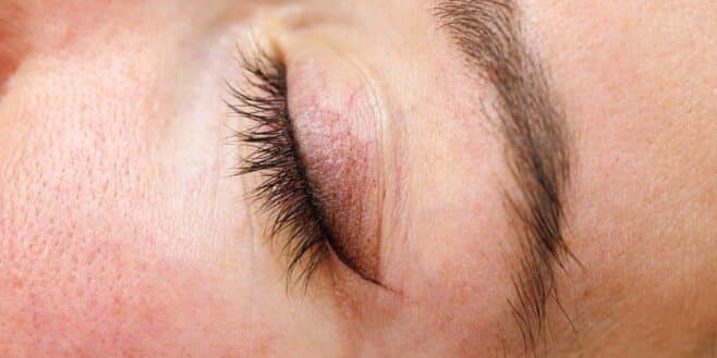 Ce simple détail sur vos paupières pourrait révéler un risque cardiaque caché, selon un médecin