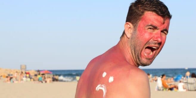 Ces 6 astuces efficaces et simples pour éviter les coups de soleil pendant les vacances d'été