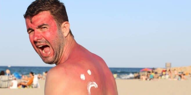 Ces 6 astuces super simples et très efficaces pour éviter les coups de soleil pendant vos vacances d’été