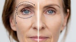 Comment gommer les rides et les cernes avec du bicarbonate ?