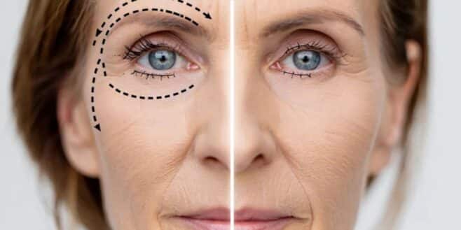 Comment gommer les rides et les cernes avec du bicarbonate ?