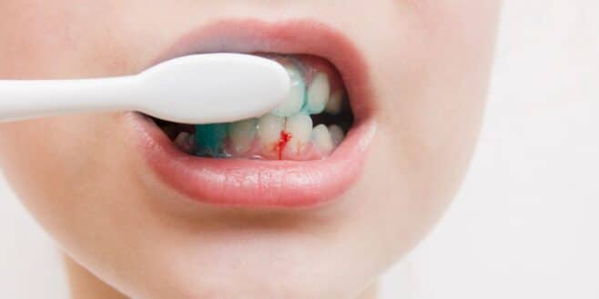 « Je croyais bien faire » : pourquoi se brosser trop souvent les dents peut abîmer votre sourire