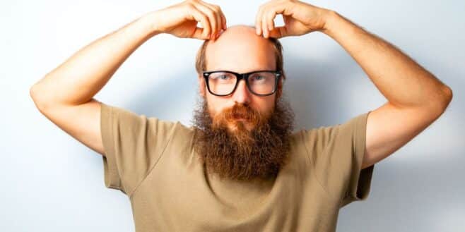 Cette substance dans les sodas et yaourts serait le remède magique contre la calvitie