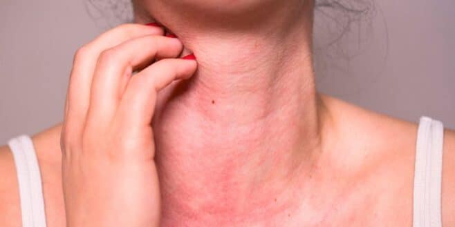 Primark : un produit très populaire déclenche une violente allergie à une cliente